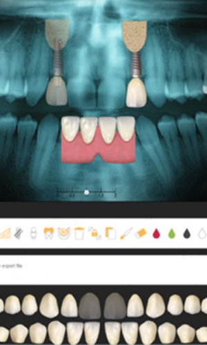 teeth xray photo 1